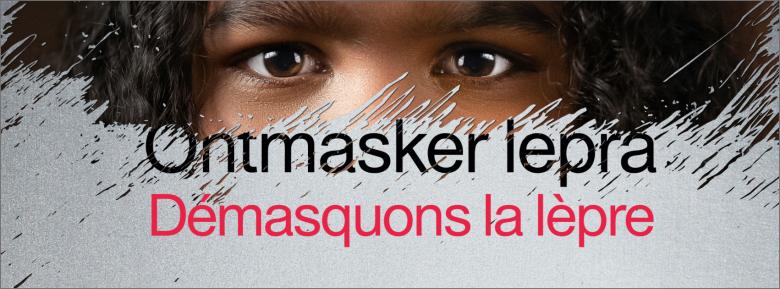 campagne damiaanactie ontmasker Lepra 